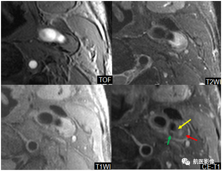 医学影像学简历_医学影像学简历_医学影像学简历