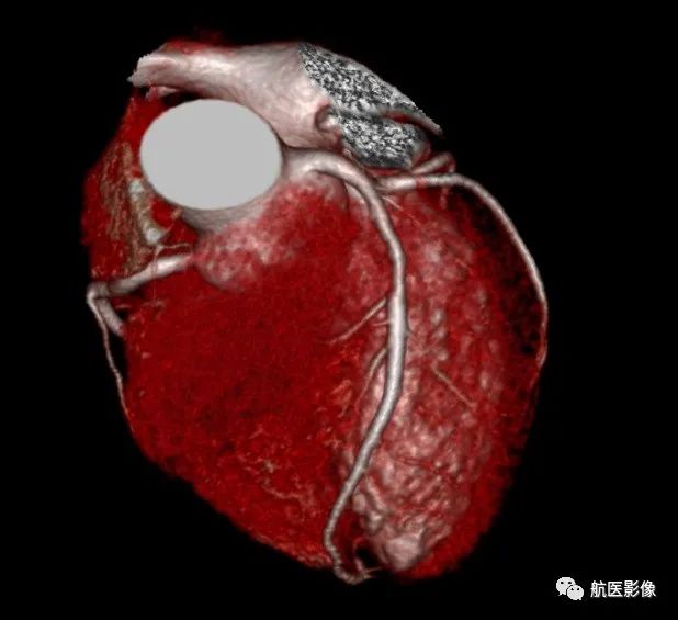 医学影像学简历_医学影像学简历_医学影像学简历