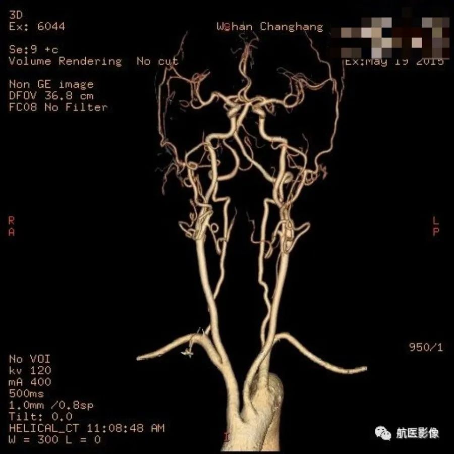 医学影像学简历_医学影像学简历_医学影像学简历