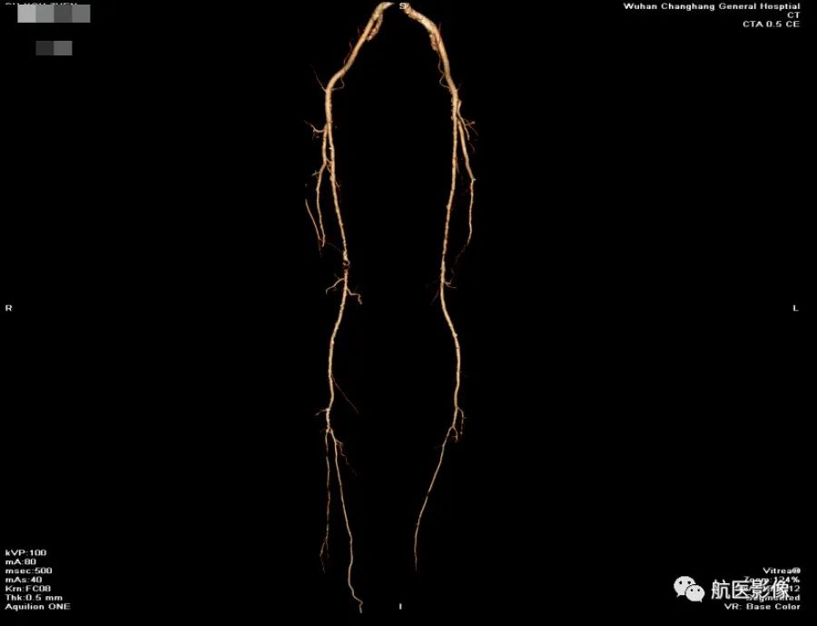 医学影像学简历_医学影像学简历_医学影像学简历