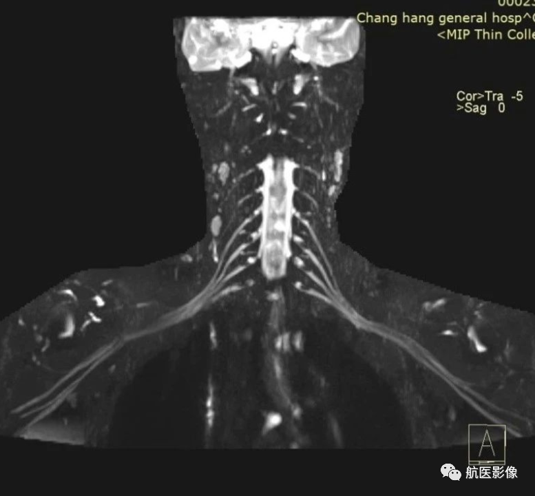 医学影像学简历_医学影像学简历_医学影像学简历
