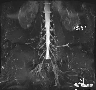 医学影像学简历_医学影像学简历_医学影像学简历