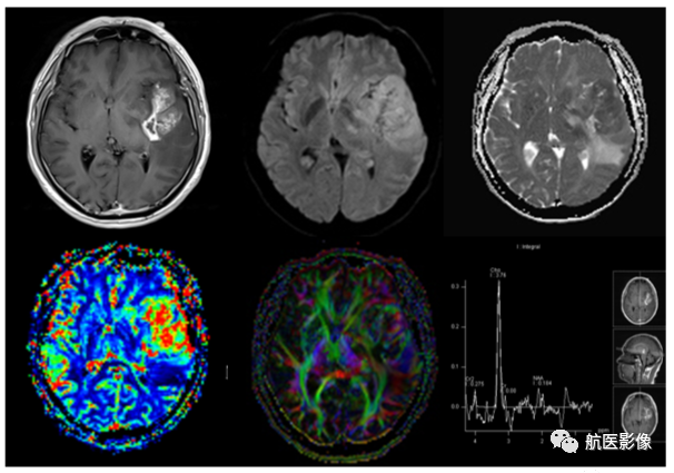医学影像学简历_医学影像学简历_医学影像学简历