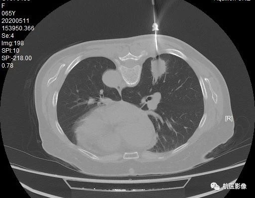 医学影像学简历_医学影像学简历_医学影像学简历