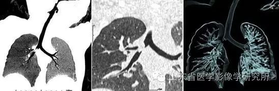 简历影像医学学位怎么写_医学影像学简历_简历影像医学学位怎么填