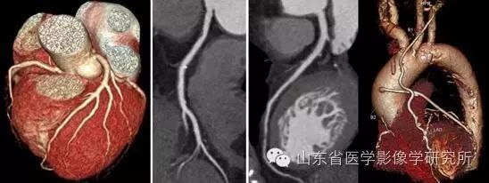 简历影像医学学位怎么填_简历影像医学学位怎么写_医学影像学简历