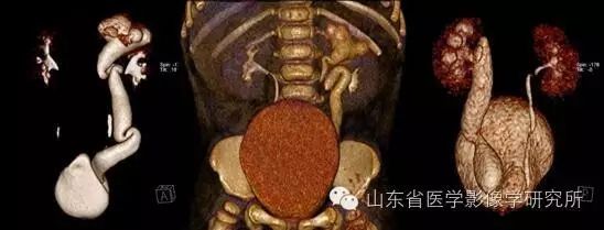 简历影像医学学位怎么填_简历影像医学学位怎么写_医学影像学简历