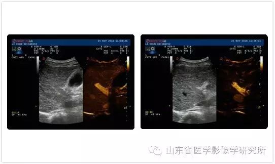 医学影像学简历模板_简历影像医学学校怎么写_医学影像学简历